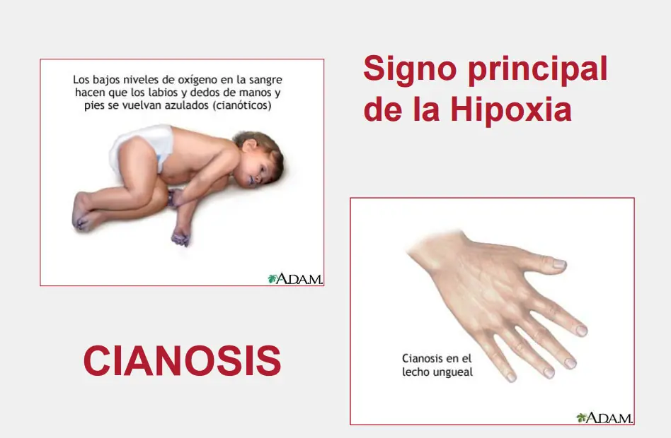 primeros auxilios