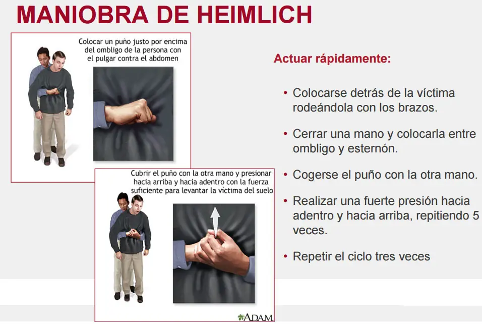 Salva vidas con este post (Primeros Auxilios) Parte 1