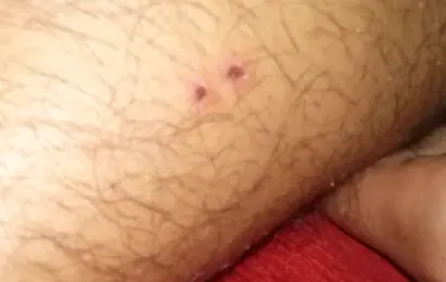 Ayuda una araña me pico alguien que me diga ¿que especie es?