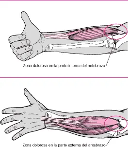 golpe