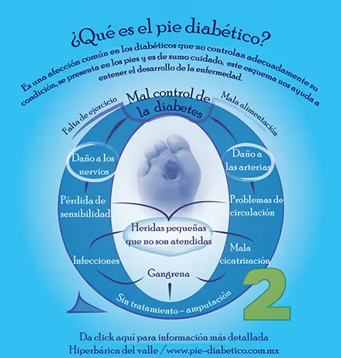 Pie diabético
