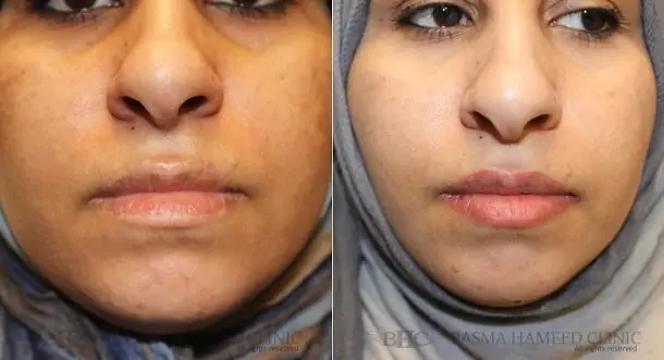 Basmaa Hameed