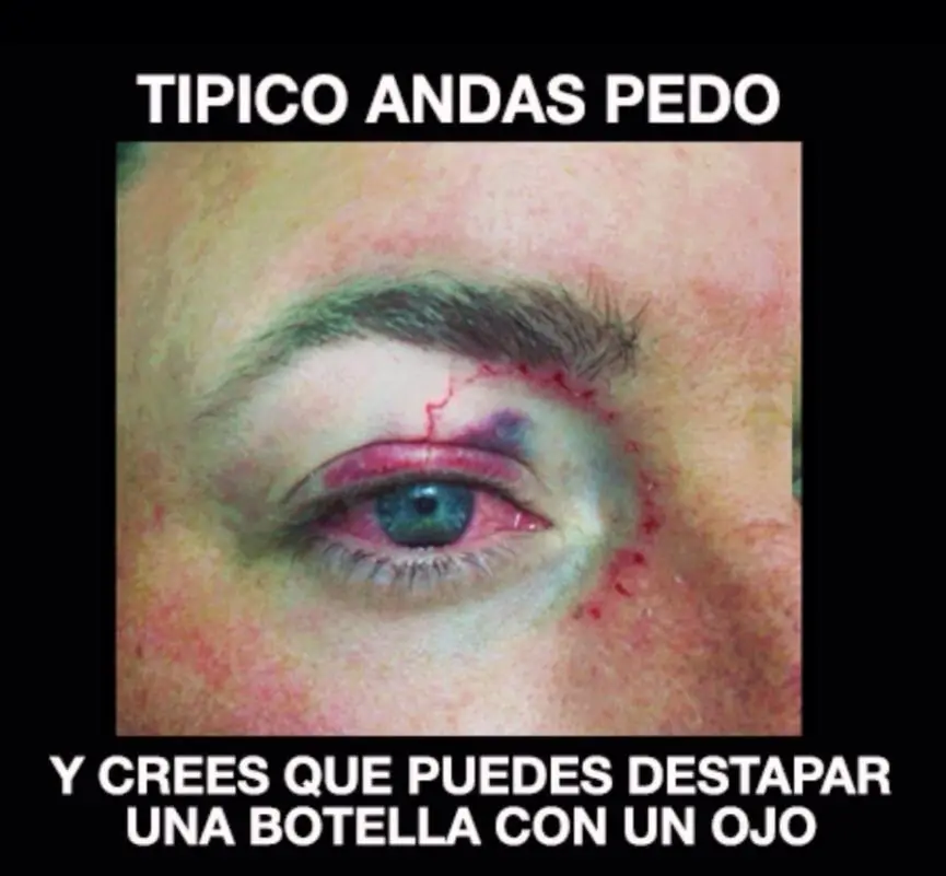 imagnes