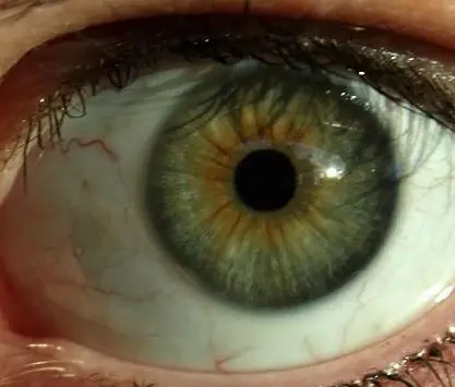 Los colores de ojos más raros en seres humanos