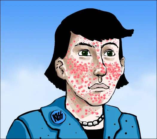 Anti Acne Anti Acne