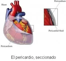 cardionector