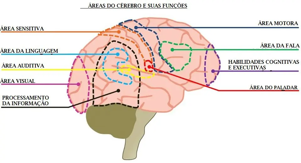hipersensibilidad al sonido hipersensibilidad al sonido