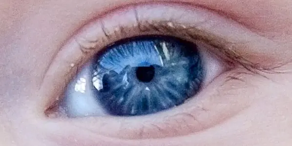 iris