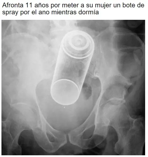 imagenes divertidas