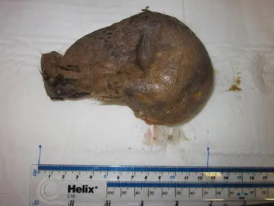 No creerás lo que le sacaron a esta mujer de su vagina