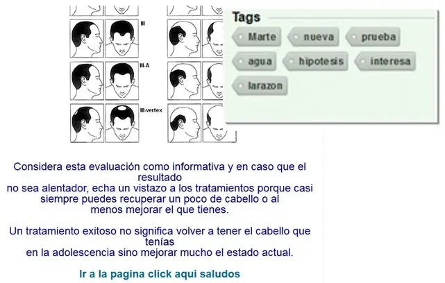 prevencion