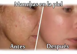 Beneficios del Limon
