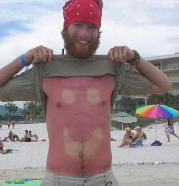 20 Personas que se olvidaron de poner protector