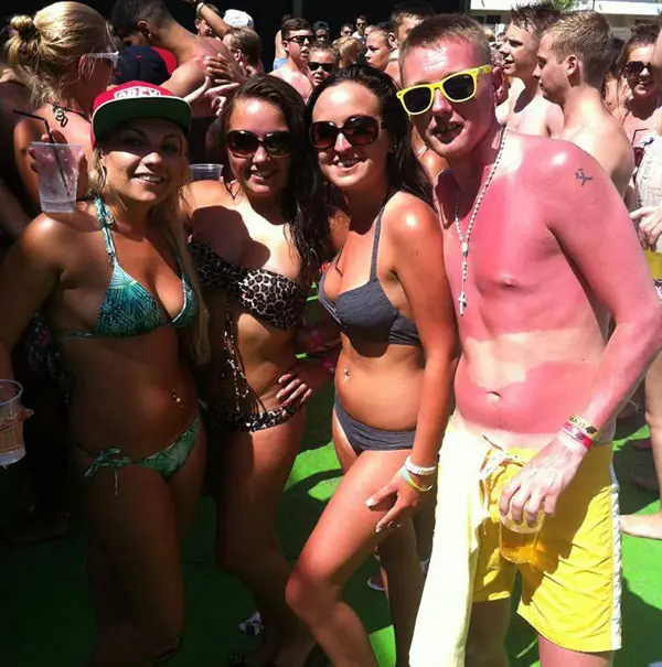 20 Personas que se olvidaron de poner protector