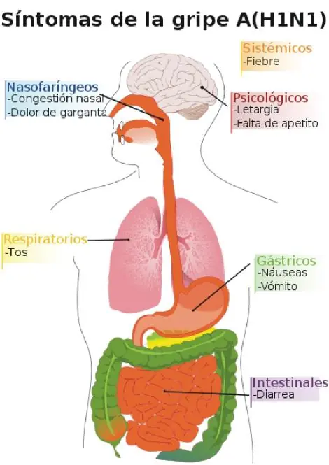 gripe A