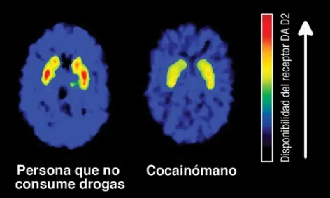 efecto