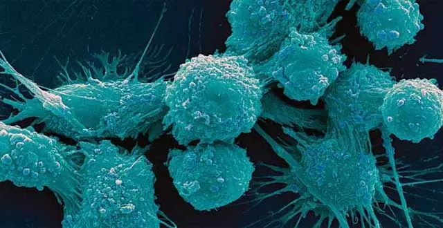 informacion sobre el cancer
