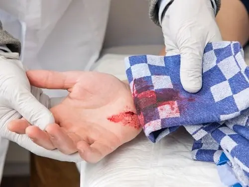 7 Errores peligrosos al Dar primeros Auxilios