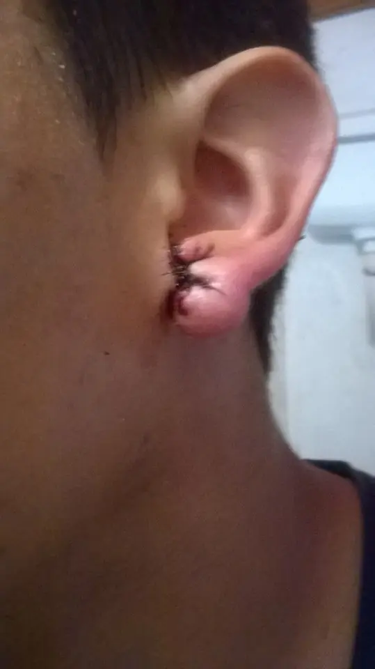 oreja