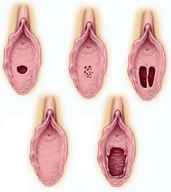 mejeres