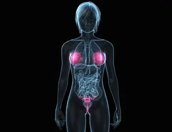 origen del cancer