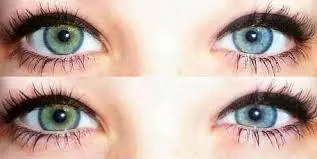 Sabes que es la Heterocromía ? -> Una Hermosa Imperfección
