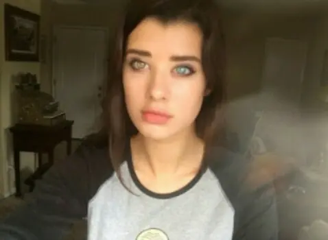 heterocromia