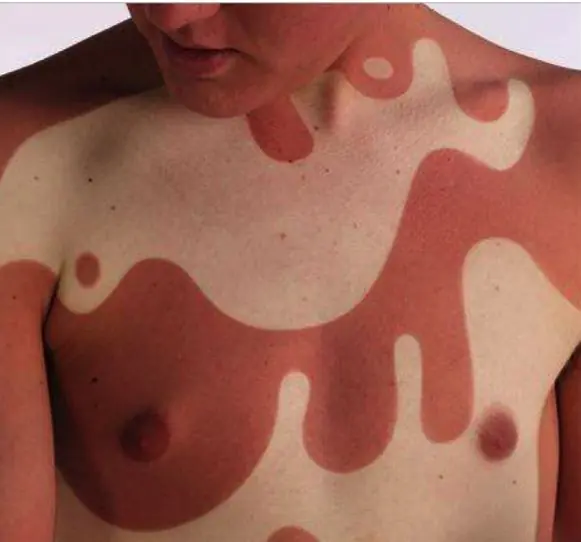 La Moda del Verano: Quemarse apropósito (Sin Palabras...)