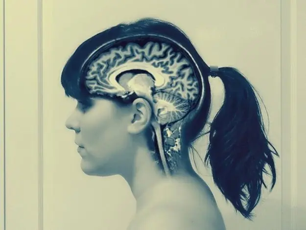 forma