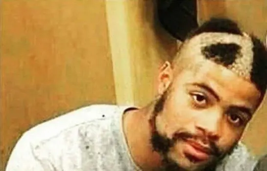 pelo pelo