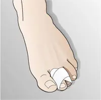 enfermedad