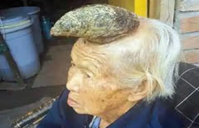 La mujer unicornio