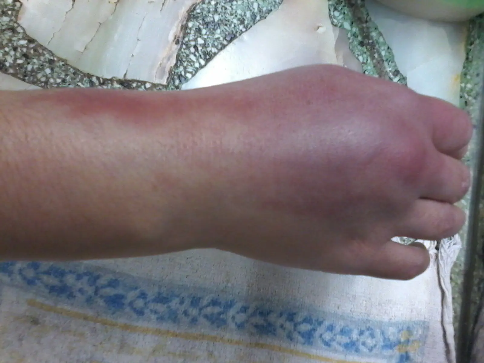 Mujer golpeada p su vecina estando drogada Miren como quedo.
