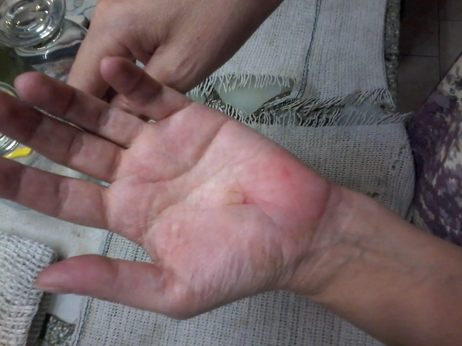 Mujer golpeada p su vecina estando drogada Miren como quedo.