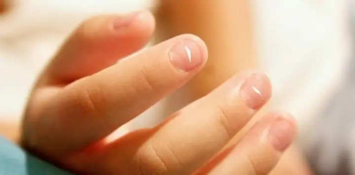 Las manchas blancas de las uñas, ¿por qué aparecen?