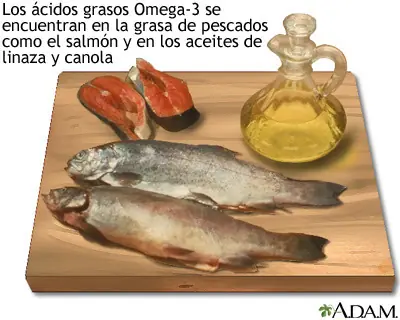 Salva tu vida con este post. ACV señales