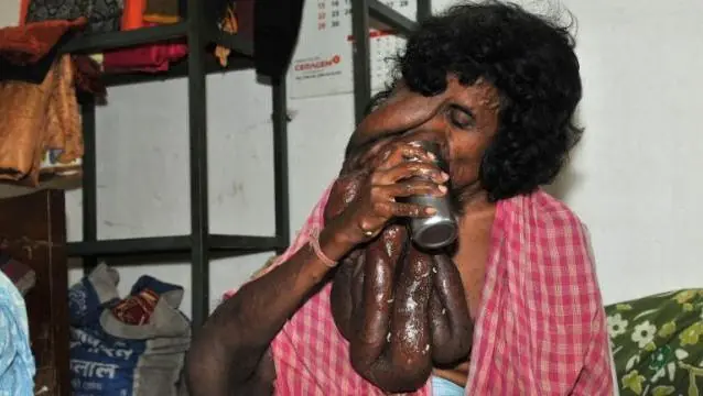 India