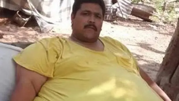 Muere en México el hombre más obeso del mundo