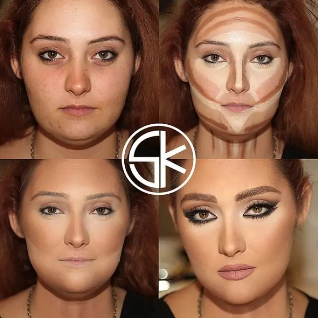 Cirugia plastica