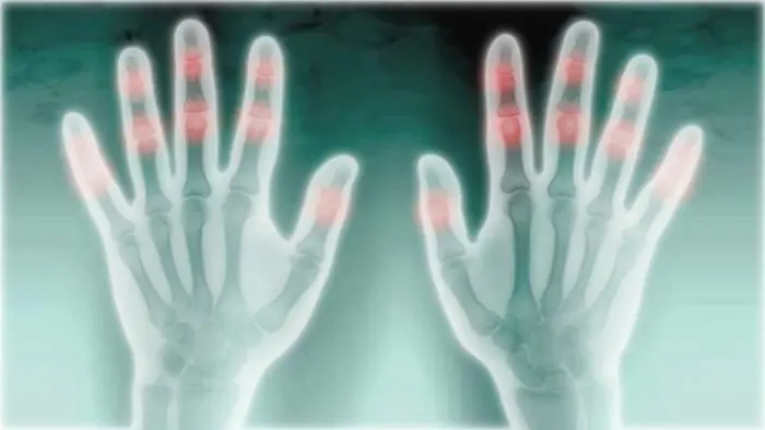deos de la mano
