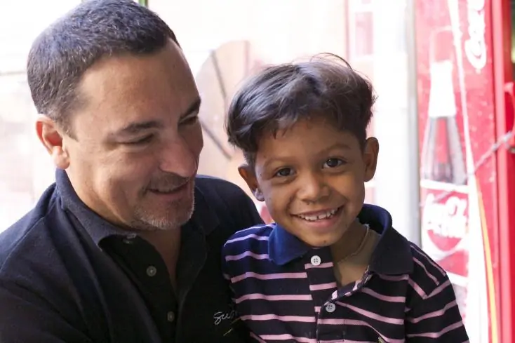 Conoce al niño tortuga y como fue su operación