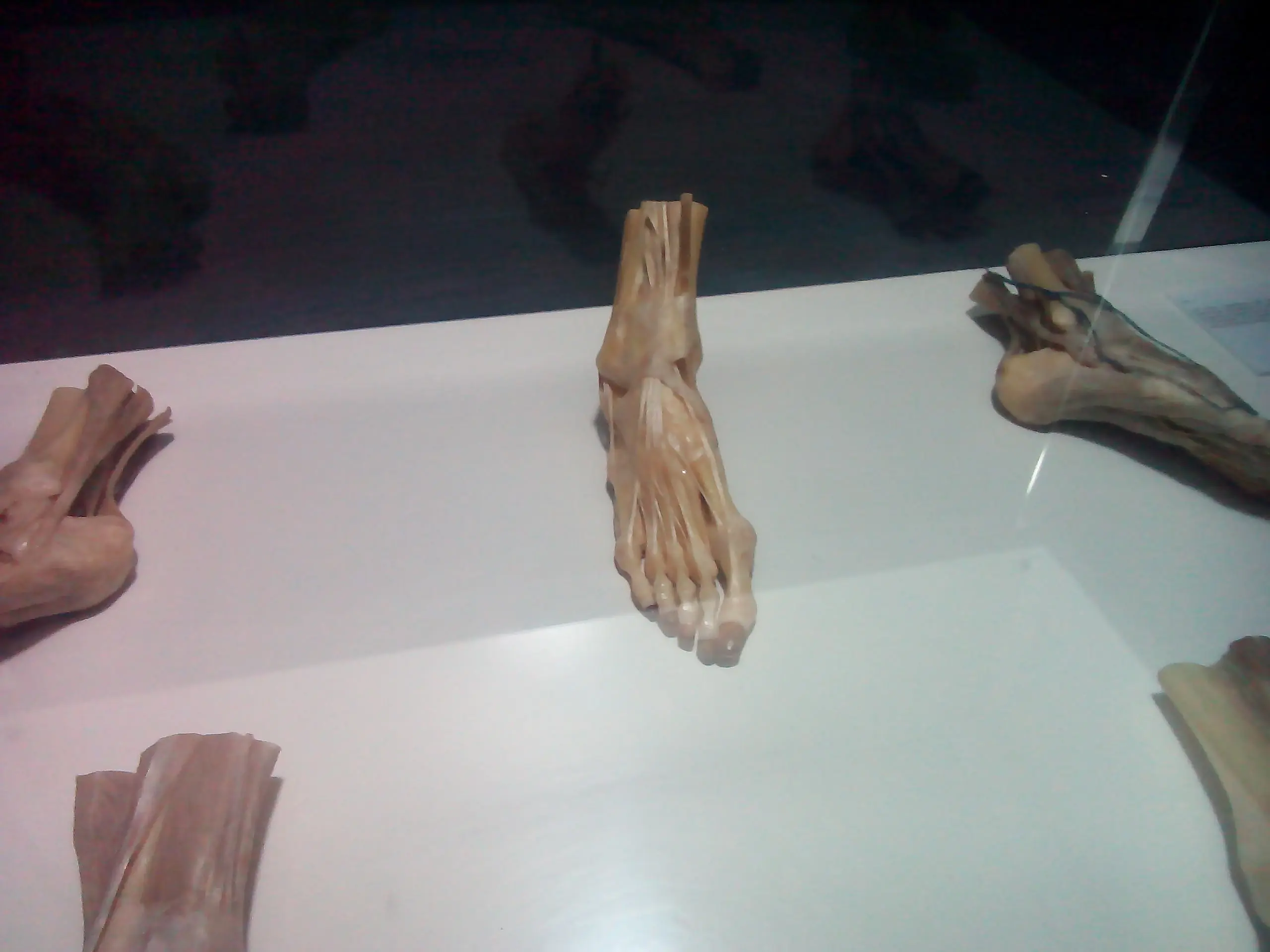 human bodies human bodies
