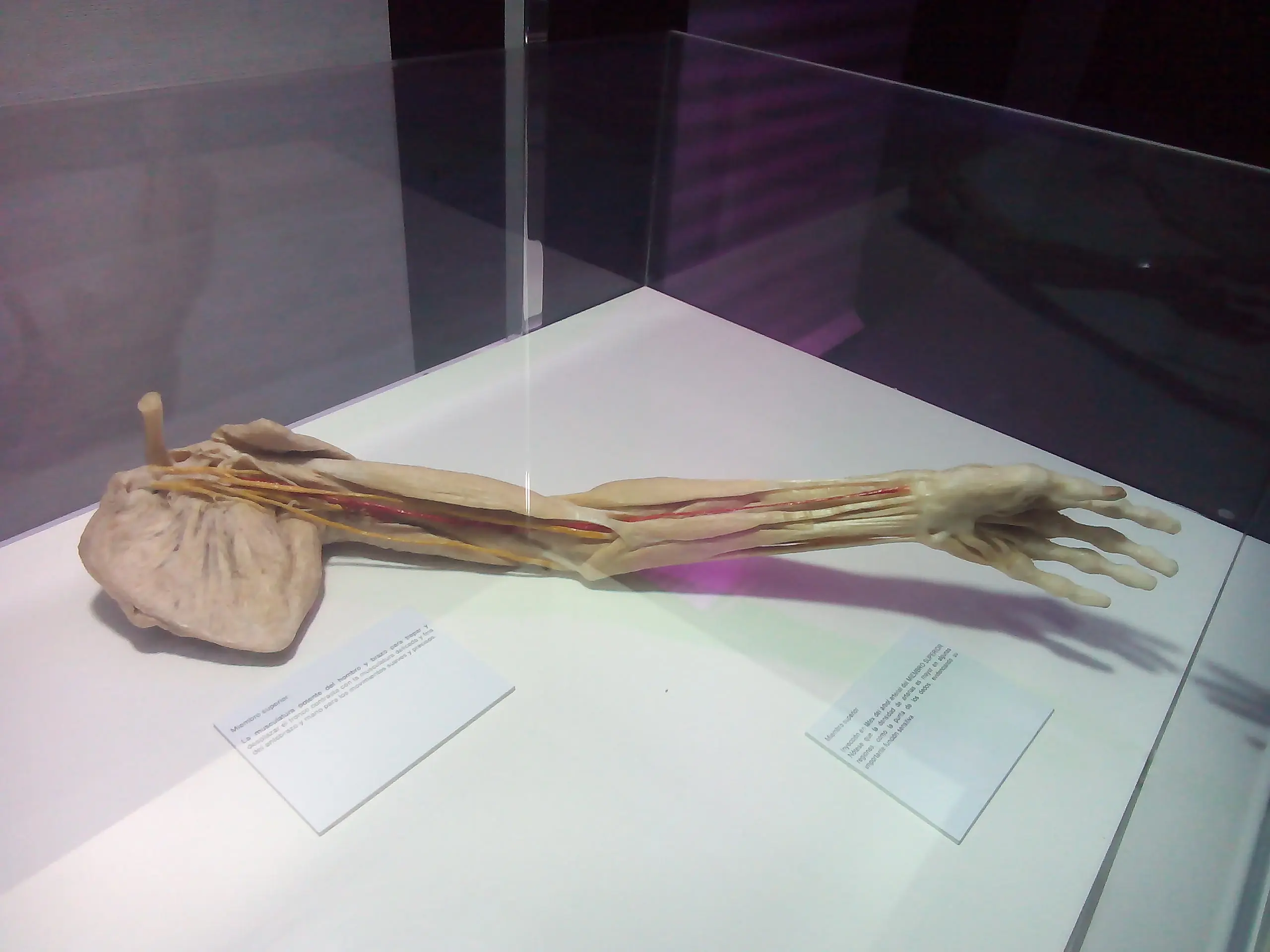 Fui a una fiambreria y te lo muestro (Human Bodies) Fui a una fiambreria y te lo muestro (Human Bodies)