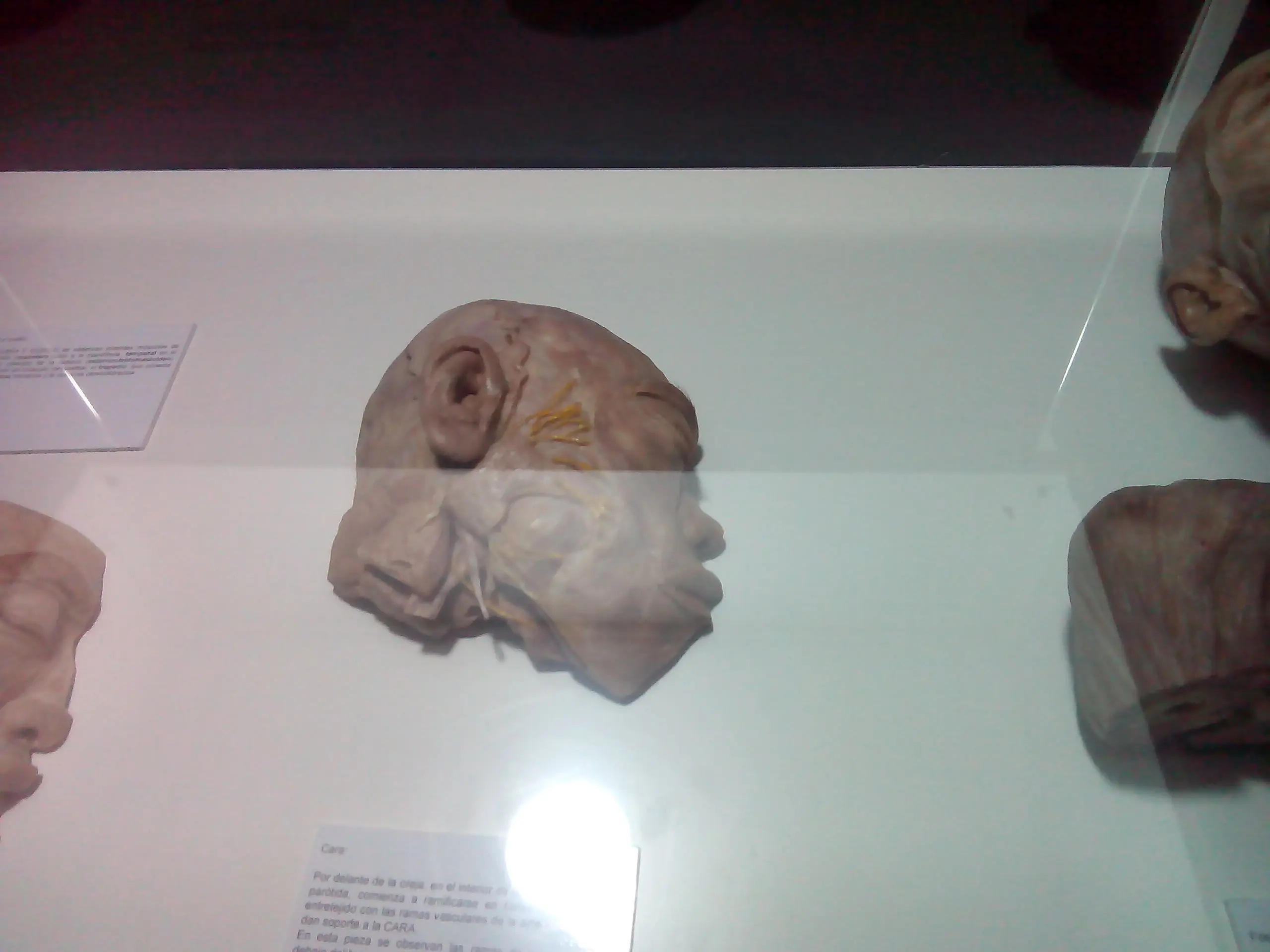 human bodies human bodies