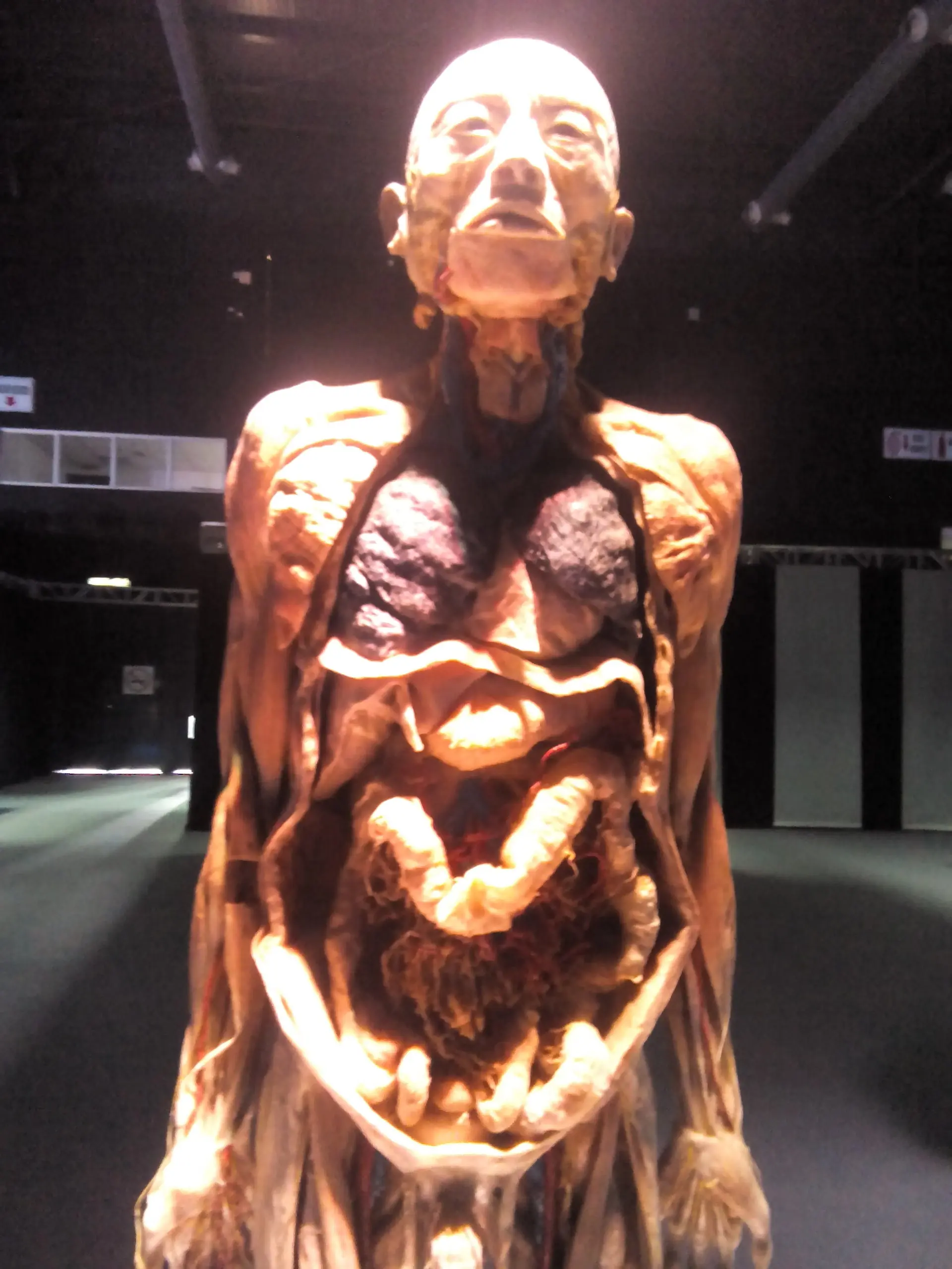 Fui a una fiambreria y te lo muestro (Human Bodies) Fui a una fiambreria y te lo muestro (Human Bodies)