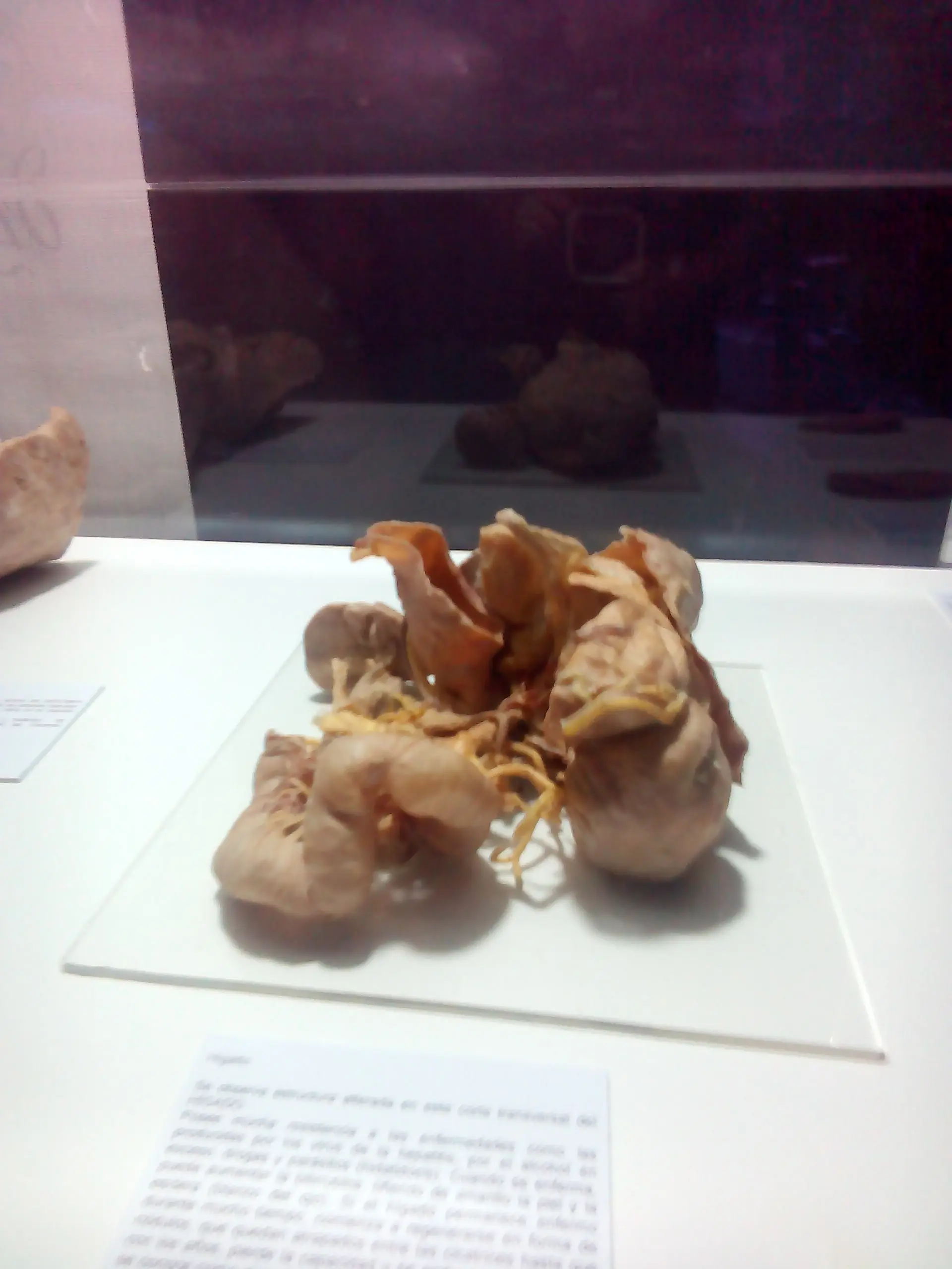 human bodies human bodies
