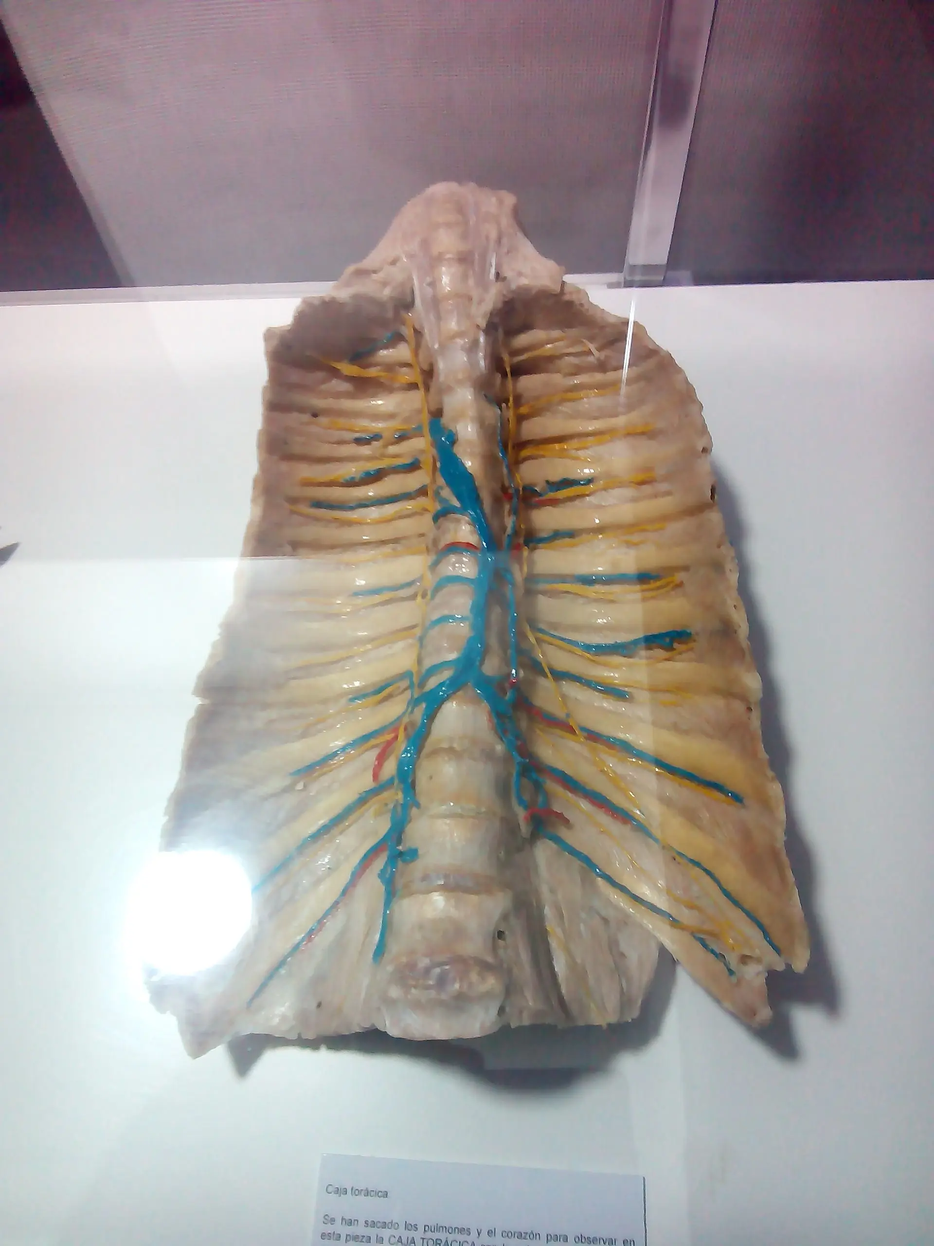 Fui a una fiambreria y te lo muestro (Human Bodies) Fui a una fiambreria y te lo muestro (Human Bodies)