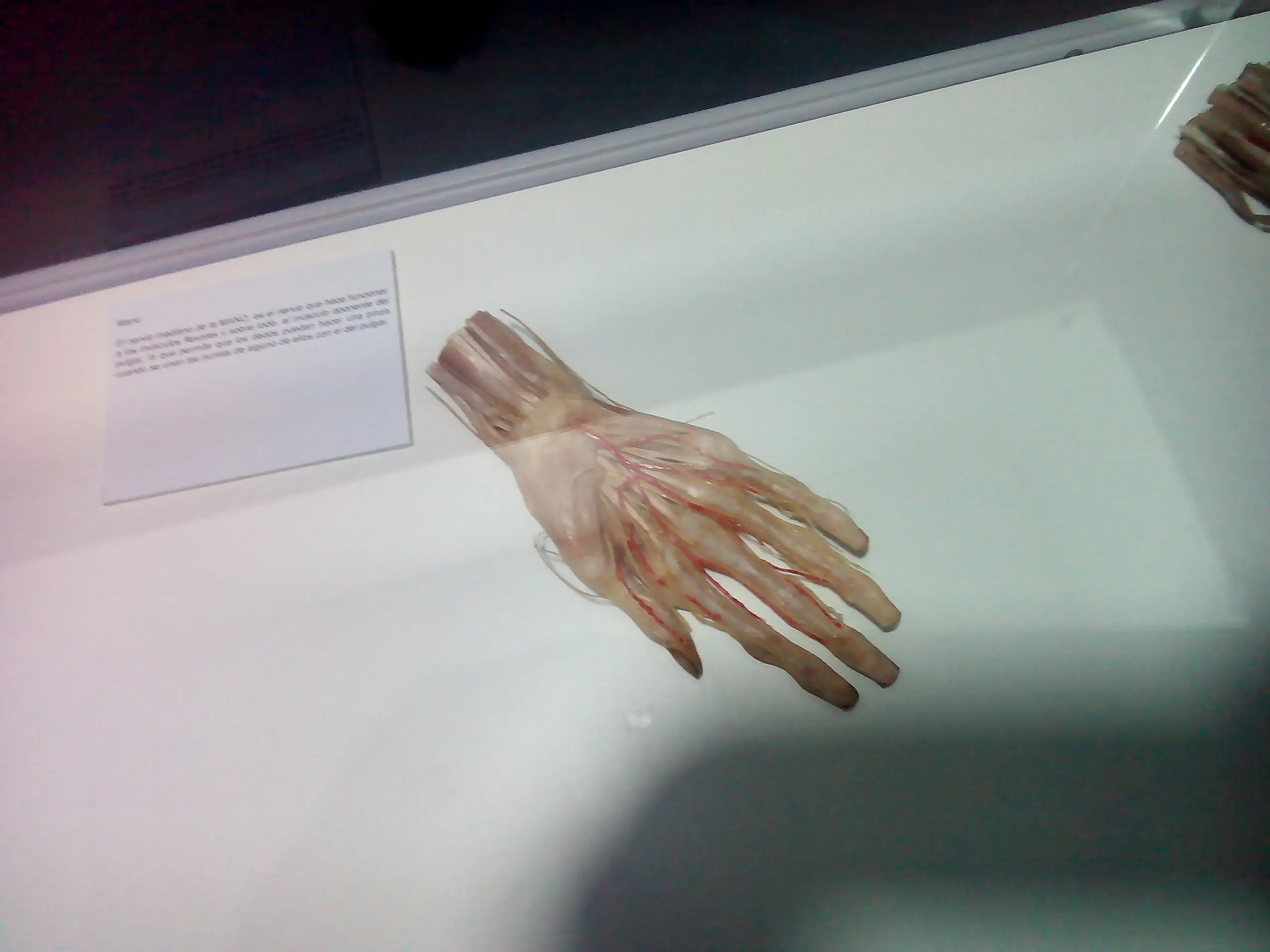 Fui a una fiambreria y te lo muestro (Human Bodies) Fui a una fiambreria y te lo muestro (Human Bodies)