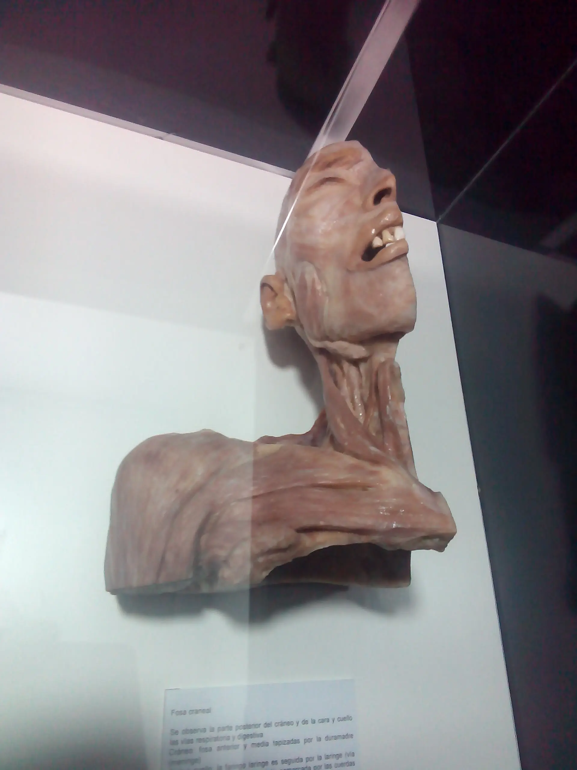 Fui a una fiambreria y te lo muestro (Human Bodies) Fui a una fiambreria y te lo muestro (Human Bodies)