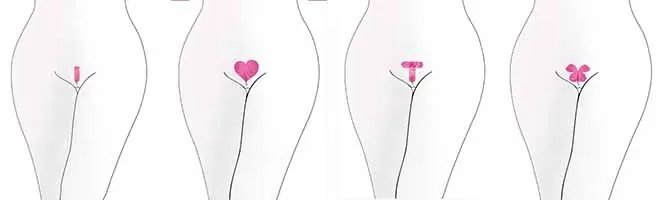Tipos de depilación vaginal